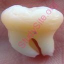 tooth (Oops! image not found)